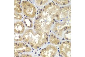Immunohistochemistry of paraffin-embedded human kidney using CEBPG antibody (ABIN5974381) at dilution of 1/100 (40x lens). (CEBPG Antikörper)