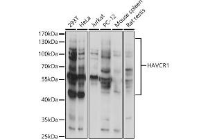 Western blot analysis of extracts of various cell lines, using H antibody (ABIN3016797, ABIN3016798, ABIN3016799 and ABIN1680157) at 1:1000 dilution. (HAVCR1 Antikörper  (AA 21-120))