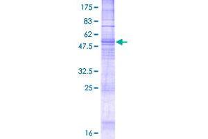 Image no. 1 for Tachykinin Receptor 1 (TACR1) (AA 1-311) protein (GST tag) (ABIN1322046) (TACR1 Protein (AA 1-311) (GST tag))