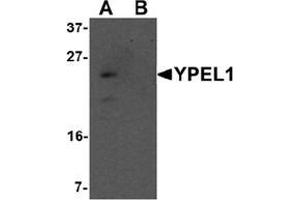 Western blot analysis of YPEL1 in Hela cell lysate with YPEL1 antibody at 1 ug/mL in (A) the absence and (B) the presence of blocking peptide. (YPEL1 Antikörper  (N-Term))