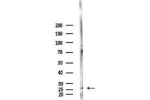 anti-Inhibitor of Growth Family, Member 4 (ING4) (Internal Region) antibody