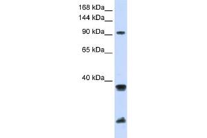 WB Suggested Anti-RNF20 Antibody Titration:  0. (RNF20 Antikörper  (Middle Region))