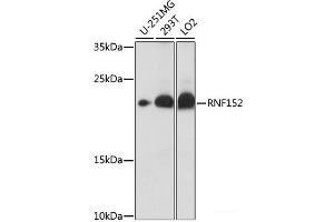 Western blot analysis of extracts of various cell lines using RNF152 Polyclonal Antibody at dilution of 1:1000. (RNF152 Antikörper)