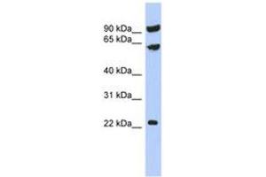 Image no. 1 for anti-Tigger Transposable Element Derived 3 (TIGD3) (AA 395-444) antibody (ABIN6743511) (TIGD3 Antikörper  (AA 395-444))