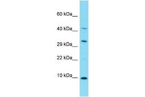 Host: Rabbit Target Name: C17orf89 Sample Type: Fetal Lung lysates Antibody Dilution: 1. (C17ORF89 Antikörper  (N-Term))