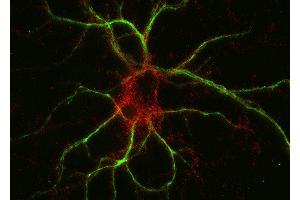 Indirect immunostaining of PFA fixed rat hippocampus neurons with anti-M6a glycoprotein (dilution 1 : 500; red) and mouse anti-MAP 2 (, dilution 1 : 500; green).