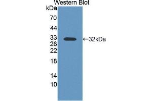 Western blot analysis of the recombinant protein. (PVRL4 Antikörper  (AA 31-317))