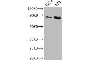 Western Blot Positive WB detected in: Hela whole cell lysate, PC-3 whole cell lysate All lanes: CUL2 antibody at 5 μg/mL Secondary Goat polyclonal to rabbit IgG at 1/50000 dilution Predicted band size: 87, 90 kDa Observed band size: 87 kDa (Cullin 2 Antikörper  (AA 591-742))