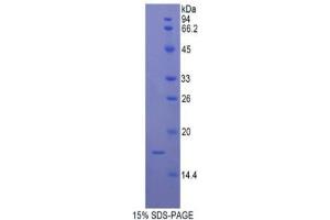SDS-PAGE analysis of Human UCP2 Protein.