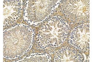 ABIN6260383 and ABIN6279247 at 1/100 staining rat testis tissue by IHC-P. (CA8 Antikörper  (C-Term))