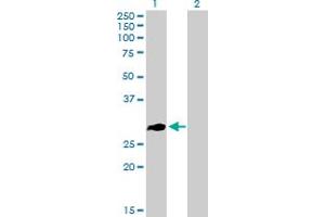 Western Blot analysis of ZNF32 expression in transfected 293T cell line by ZNF32 MaxPab polyclonal antibody. (ZNF32 Antikörper  (AA 1-273))