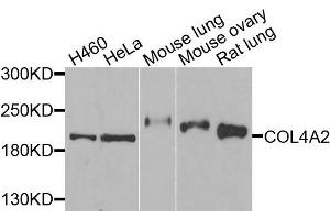 Western blot analysis of extracts of various cells, using COL4A2 antibody. (COL4a2 Antikörper)