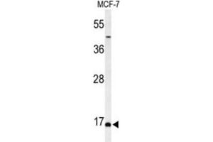 Western Blotting (WB) image for anti-Biorientation of Chromosomes in Cell Division 1 (BOD1) antibody (ABIN3004401) (BOD1 Antikörper)