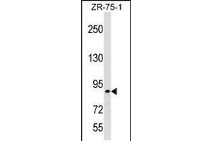 Western blot analysis in ZR-75-1 cell line lysates (35ug/lane). (RASA3 Antikörper  (C-Term))