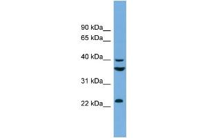 WB Suggested Anti-SAE1  Antibody Titration: 0. (SAE1 Antikörper  (N-Term))