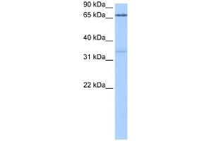 PADI2 antibody used at 0. (PADI2 Antikörper  (Middle Region))