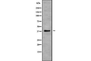 Western blot analysis of CCR10 using COLO205 whole cell lysates (CCR10 Antikörper  (C-Term))