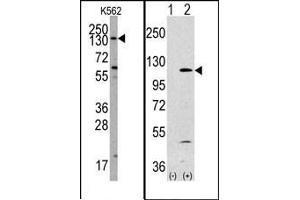 Image no. 1 for anti-Phosphoinositide-3-Kinase, Catalytic, alpha Polypeptide (PIK3CA) (Middle Region) antibody (ABIN360445) (PIK3CA Antikörper  (Middle Region))