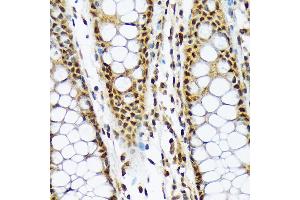 Immunohistochemistry of paraffin-embedded human colon using ML1BP Rabbit mAb (ABIN7268357) at dilution of 1:100 (40x lens). (MAD2L1BP Antikörper)