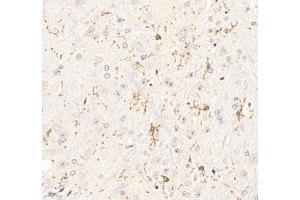 Immunohistochemistry of paraffin embedded mouse brain using P2Y12 (ABIN7075321) at dilution of 1: 1400 (400x lens) (P2RY12 Antikörper)