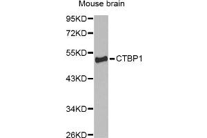 Western blot analysis of extracts of mouse brain, using CTBP1 Antibody (ABIN1872055) at 1:1000 dilution. (CTBP1 Antikörper)