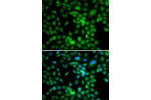 Immunofluorescence analysis of MCF-7 cells using SYCE1 antibody (ABIN5974347). (SYCE1 Antikörper)