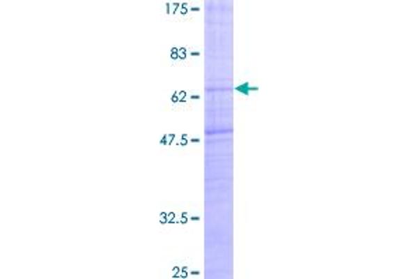 MCHR1 Protein (AA 1-422) (GST tag)