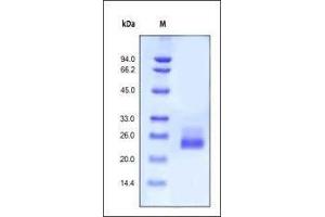 SDS-PAGE (SDS) image for Interleukin 6 (IL6) (AA 30-212) (Active) protein (ABIN2181322)