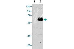 Western blot analysis of MAPT (arrow) using MAPT polyclonal antibody .