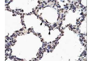 Image no. 1 for anti-Nuclear Factor of kappa Light Polypeptide Gene Enhancer in B-Cells 2 (NFKB2) (AA 65-114) antibody (ABIN6735898)