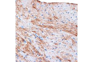 Immunohistochemistry of paraffin-embedded mouse heart using α-Actin-1  Rabbit mAb (ABIN1682816, ABIN7101454, ABIN7101455 and ABIN7101456) at dilution of 1:100 (40x lens). (Actin (Alpha-Actin) Antikörper)