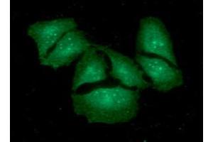 ICC/IF analysis of KCTD15 in HeLa cells. (KCTD15 Antikörper  (AA 1-159))