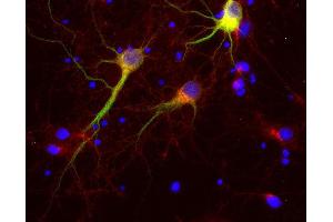 Indirect immunolabeling of PFA fixed rat hippocampus neurons with rabbit anti-Vti1a (dilution 1 : 500; red) and mouse anti-MAP 2 (cat.