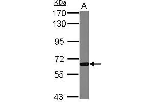 Western Blotting (WB) image for anti-Glucokinase (Hexokinase 4) Regulator (GCKR) (AA 1-214) antibody (ABIN1501890)
