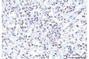 IHC analysis of RBM22 using anti-RBM22 antibody (ABIN7600268). (RBM22 Antikörper  (AA 17-406))