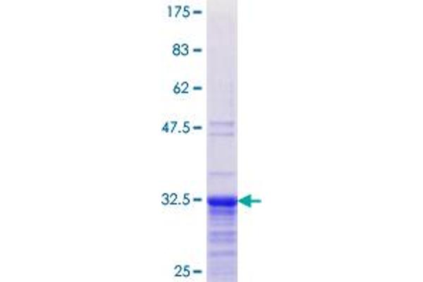 TNP1 Protein (AA 1-55) (GST tag)