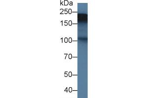 Western blot analysis of Rat Placenta lysate, using Rat TNC Antibody (1. (TNC Antikörper  (AA 513-621))