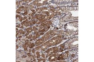 Immunohistochemical staining of human stomach with LRCH4 polyclonal antibody  shows strong cytoplasmic and membranous positivity in glandular cells.