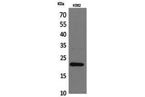 Western Blotting (WB) image for anti-Interleukin 6 (IL6) antibody (ABIN5959615) (IL-6 Antikörper)