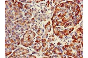 Immunohistochemistry of paraffin-embedded human pancreatic tissue using ABIN7151134 at dilution of 1:100 (RNF126 Antikörper  (AA 39-225))