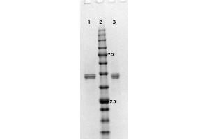 MEK2 Protein