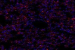 Immunofluorescent analysis of paraformaldehyde-fixed mouse lung using,NTR3 (ABIN7075690) at dilution of 1: 800 (Sortilin 1 Antikörper)