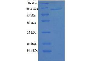 SDS-PAGE (SDS) image for Galectin 6 (GAL6) (AA 1-301), (full length) protein (GST tag) (ABIN5709847)
