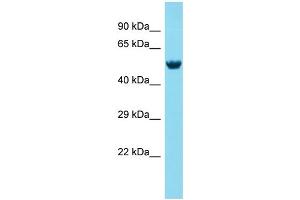 Host: Rabbit Target Name: MEX3A Sample Type: Fetal Brain lysates Antibody Dilution: 1. (MEX3A Antikörper  (N-Term))