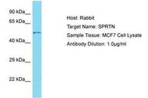 Image no. 1 for anti-Chromosome 1 Open Reading Frame 124 (C1orf124) (AA 186-235) antibody (ABIN6750700) (Spartan Antikörper  (AA 186-235))