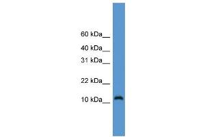 WB Suggested Anti-CDC26 Antibody Titration: 0.
