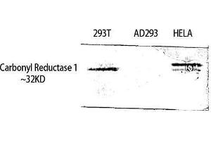 Western Blotting (WB) image for anti-Carbonyl Reductase 1 (CBR1) (Internal Region) antibody (ABIN3183645) (CBR1 Antikörper  (Internal Region))