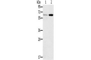 Western Blotting (WB) image for anti-Tumor Necrosis Factor Receptor Superfamily, Member 11a, NFKB Activator (TNFRSF11A) antibody (ABIN2827208) (TNFRSF11A Antikörper)