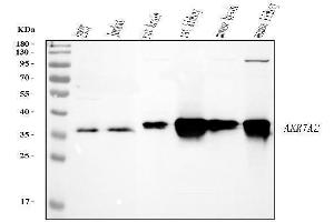 Western blot analysis of AKR7A2 using anti-AKR7A2 antibody (ABIN7601157).