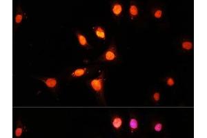 Immunofluorescence analysis of U-2 OS cells using KAT2A Polyclonal Antibody at dilution of 1:100 (40x lens). (KAT2A Antikörper)